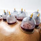 Ventouses / Hijama — Sénégal